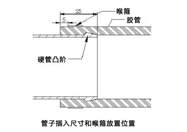 河间喉箍使用标准